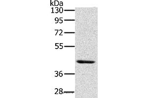 Western blot analysis of Skov3 cell, using HSD3B7 Polyclonal Antibody at dilution of 1:400