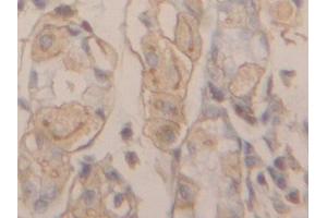 Immunohistochemistry (IHC) image for anti-Actin, gamma 1 (ACTG1) (AA 1-375) antibody (ABIN7437917)