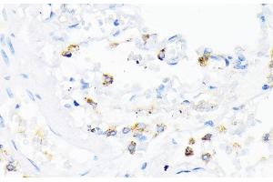 Immunohistochemistry of paraffin-embedded Human lung using CAMP Polyclonal Antibody at dilution of 1:200 (40x lens). (Cathelicidin antibody)