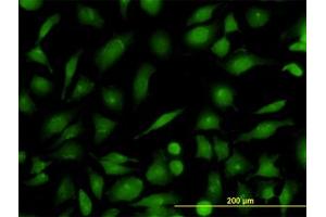 Image no. 3 for anti-RAB21, Member RAS Oncogene Family (RAB21) (AA 116-226) antibody (ABIN599189) (RAB21 antibody  (AA 116-226))