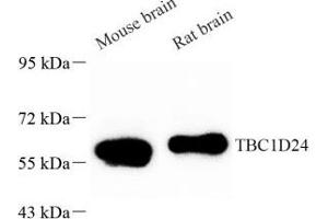 Western blot analysis of TBC1D24 (ABIN7075847) at dilution of 1: 1000 (TBC1D24 antibody)