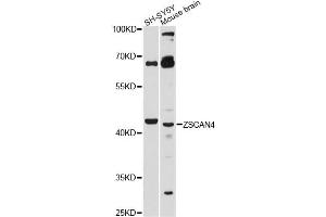Western blot analysis of extracts of various cell lines, using ZSCAN4 antibody. (ZSCAN4 antibody)