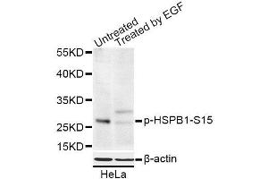 Western blot analysis of extracts of HeLa cells, using Phospho-HSPB1-S15 antibody (ABIN5969897) at 1/1000 dilution. (HSP27 antibody  (pSer15))