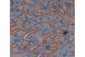 Immunohistochemistry (IHC) image for anti-Polymeric Immunoglobulin Receptor (PIGR) (AA 352-457) antibody (ABIN1860213)