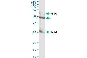 Immunoprecipitation of TALDO1 transfected lysate using anti-TALDO1 MaxPab rabbit polyclonal antibody and Protein A Magnetic Bead , and immunoblotted with TALDO1 MaxPab rabbit polyclonal antibody (D01) . (TALDO1 antibody  (AA 1-337))