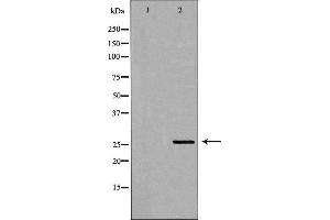 Western blot analysis of transfected 293T cell line, using ELSPBP1 Antibody. (ELSPBP1 antibody  (C-Term))