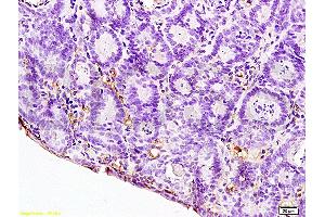 Formalin-fixed and paraffin embedded rat colitis labeled with Anti-IL-12 Polyclonal Antibody, Unconjugated (ABIN672951) at 1:200, followed by conjugation to the secondary antibody and DAB staining