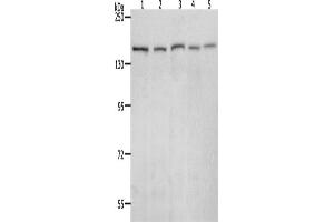 Western Blotting (WB) image for anti-RAD50 Homolog (S. Cerevisiae) (RAD50) antibody (ABIN2426375) (RAD50 antibody)