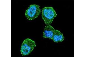 Confocal immunofluorescent analysis of LKB1 antibody with ZR-75-1 cells followed by Alexa Fluor 488-conjugated goat anti-rabbit lgG (green). (LKB1 antibody  (AA 19-48))
