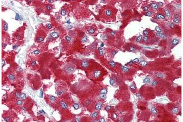 THEM6 antibody  (N-Term)