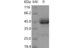 Western Blotting (WB) image for Interleukin 13 Receptor, alpha 2 (IL13RA2) (Active) protein (His tag) (ABIN7196403)