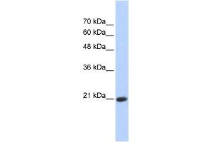 WB Suggested Anti-TCEAL8 Antibody Titration:  0. (TCEAL8 antibody  (Middle Region))