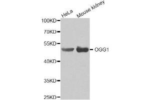 Western blot analysis of extracts of various cell lines, using OGG1 antibody(1:200). (OGG1 antibody)