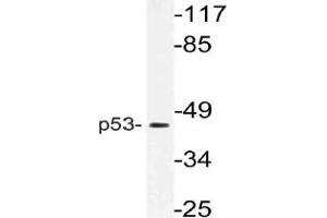 Western blot (WB) analysis of p53 antibody in extracts from HT-29 cells. (p53 antibody)