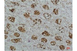 Immunohistochemical analysis of paraffin-embedded Human Kidney Tissue using IκB βMouse mAb diluted at 1:200. (NFKBIB antibody)