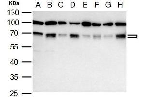 WB Image NRF1 antibody detects NRF1 protein by western blot analysis.