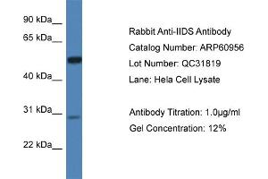 Western Blotting (WB) image for anti-Iduronate 2-Sulfatase (IDS) (N-Term) antibody (ABIN2788631)