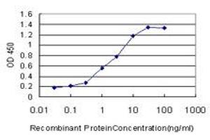 Detection limit for recombinant GST tagged ANKRD15 is approximately 0. (ANKRD15 antibody  (AA 701-800))