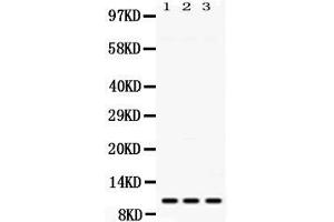 Western blot analysis of MPS1 expression in rat spleen extract ( Lane 1), mouse liver extract ( Lane 2) and HELA whole cell lysates ( Lane 3).