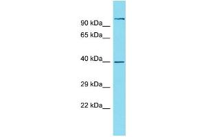 Western Blotting (WB) image for anti-Nudix (Nucleoside Diphosphate Linked Moiety X)-Type Motif 19 (NUDT19) (N-Term) antibody (ABIN2774538)