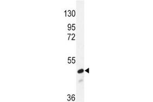 Western Blotting (WB) image for anti-SMAD, Mothers Against DPP Homolog 2 (SMAD2) (AA 97-125) antibody (ABIN3032613)