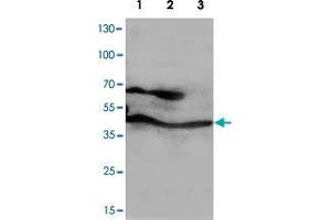 Western blot analysis of whole cell lysates with PPID polyclonal antibody .