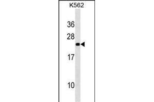 NOP16 Antibody (C-term) (ABIN1536695 and ABIN2850316) western blot analysis in K562 cell line lysates (35 μg/lane). (NOP16 antibody  (C-Term))