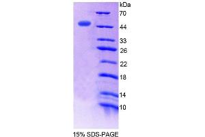 SDS-PAGE analysis of Human ERI1 Protein.