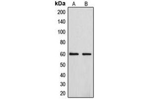 Western blot analysis of Cytochrome P450 4F2 expression in A549 (A), HepG2 (B) whole cell lysates.
