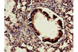 Immunohistochemistry of paraffin-embedded human lung tissue using ABIN7155665 at dilution of 1:100 (CDX4 antibody  (AA 16-174))
