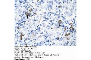 Human Liver (TRIM17 / RNF16 antibody  (Middle Region))