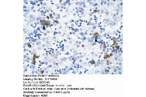 Human Liver (TRIM17 / RNF16 antibody  (Middle Region))