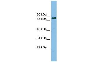 Lamin B Receptor antibody used at 1 ug/ml to detect target protein. (Lamin B Receptor antibody  (Middle Region))