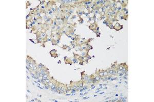 Immunohistochemistry of paraffin-embedded human prostate using NEDD4L antibody at dilution of 1:200 (40x lens). (NEDD4-2 antibody)