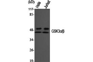 Western Blotting (WB) image for anti-Glycogen Synthase Kinase 3 alpha/beta (GSK3a/b) (Tyr216), (Tyr279) antibody (ABIN5956808) (GSK3 alpha/beta antibody  (Tyr216, Tyr279))
