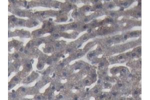 IHC-P analysis of Rabbit Liver Tissue, with DAB staining.