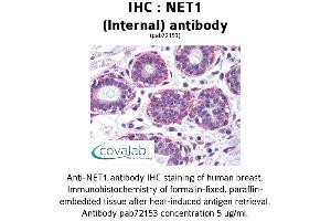 Image no. 1 for anti-Neuroepithelial Cell Transforming 1 (NET1) (Internal Region) antibody (ABIN1737274) (NET1 antibody  (Internal Region))
