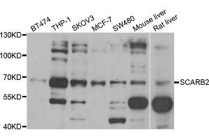 Western blot analysis of extracts of various cell lines, using SCARB2 antibody (ABIN5973710) at 1/1000 dilution. (SCARB2 antibody)