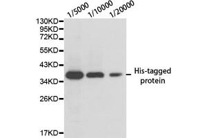 Image no. 3 for anti-His Tag antibody (ABIN2932978) (His Tag antibody)