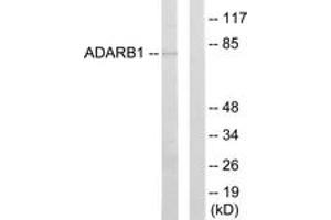 Western Blotting (WB) image for anti-Adenosine Deaminase, RNA-Specific, B1 (ADARB1) (AA 481-530) antibody (ABIN2889537)
