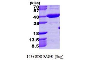 SDS-PAGE (SDS) image for Aldo-keto Reductase Family 1 Member C4 (AKR1C4) (AA 1-323) protein (His tag) (ABIN667485) (AKR1C4 Protein (AA 1-323) (His tag))