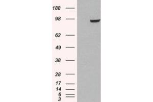 Western Blotting (WB) image for anti-phosphodiesterase 5A, cGMP-Specific (PDE5A) (C-Term) antibody (ABIN2466086) (PDE5A antibody  (C-Term))