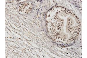 Immunoperoxidase of monoclonal antibody to ZNF92 on formalin-fixed paraffin-embedded human prostate. (ZNF92 antibody  (AA 490-586))