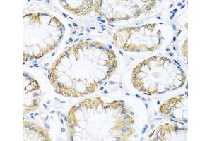 Immunohistochemistry of paraffin-embedded Human stomach using PCDHA12 Polyclonal Antibody at dilution of 1:100 (40x lens). (PCDHA12 antibody)