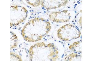 Immunohistochemistry of paraffin-embedded Human stomach using PCDHA12 Polyclonal Antibody at dilution of 1:100 (40x lens).