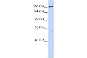 Western Blotting (WB) image for anti-ATP-Binding Cassette, Sub-Family C (CFTR/MRP), Member 1 (ABCC1) antibody (ABIN2458767)
