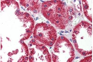 Human Kidney: Formalin-Fixed, Paraffin-Embedded (FFPE) (HINT1 antibody  (AA 38-87))