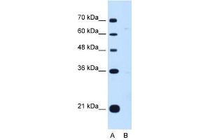 DONSON antibody used at 1 ug/ml to detect target protein. (DONSON antibody  (Middle Region))