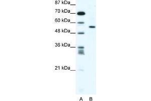 WB Suggested Anti-RUNX2 Antibody Titration:  1. (RUNX2 antibody  (Middle Region))