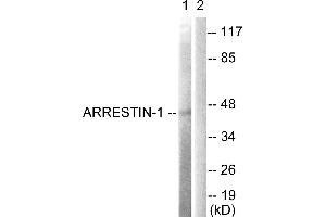 Immunohistochemistry analysis of paraffin-embedded human brain tissue using Arrestin 1 (Ab-412) antibody. (SAG antibody  (Ser412))